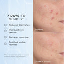 Niacinamide Peptides 30ml
