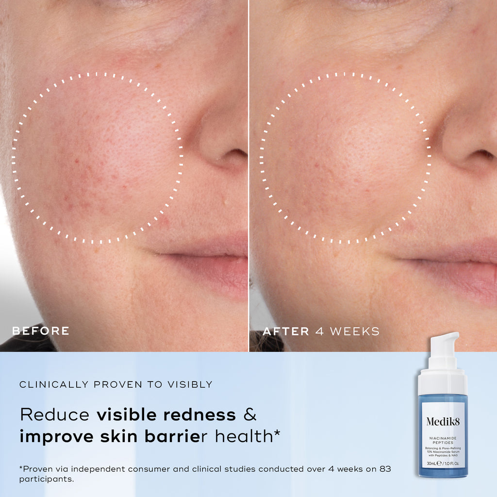 Niacinamide Peptides 30ml