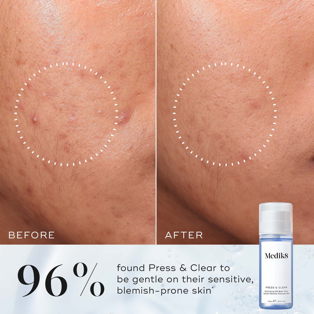 Press & Clear 150ml
